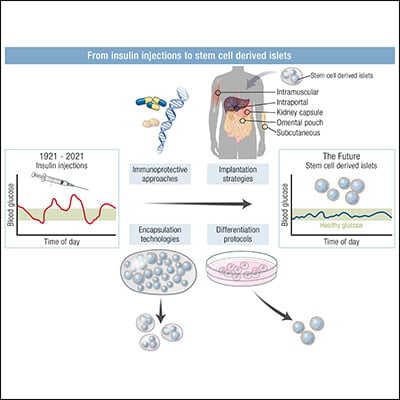 Stem Cell Derived Islets To Treat Diabetes Endocrine Society