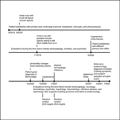 Delayed Diagnosis of Ectopic Cushing Syndrome | Endocrine Society