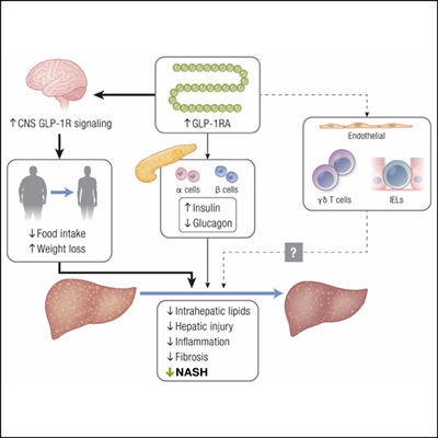 GLP-1 and Nonalcoholic Steatohepatitis | Endocrine Society