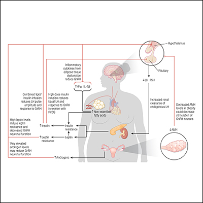 Obesity-Related Hypogonadism in Women | Endocrine Society