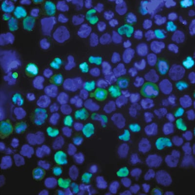 PTH-Positive Cells From Pluripotent Stem Cells | Endocrine Society