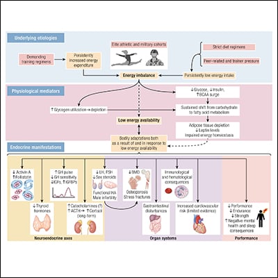 Relative Energy Deficiency in Sport | Endocrine Society