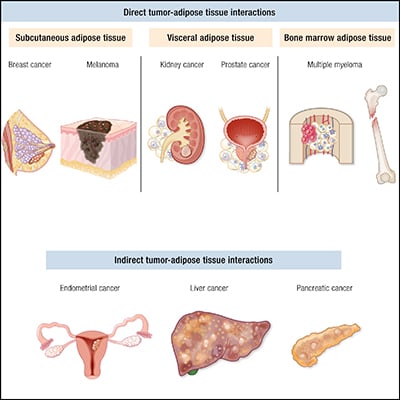 https://www.endocrine.org/-/media/endocrine/images/journal-articles/update-on-adipose-tissue-and-cancer-graphical-abstract.jpg