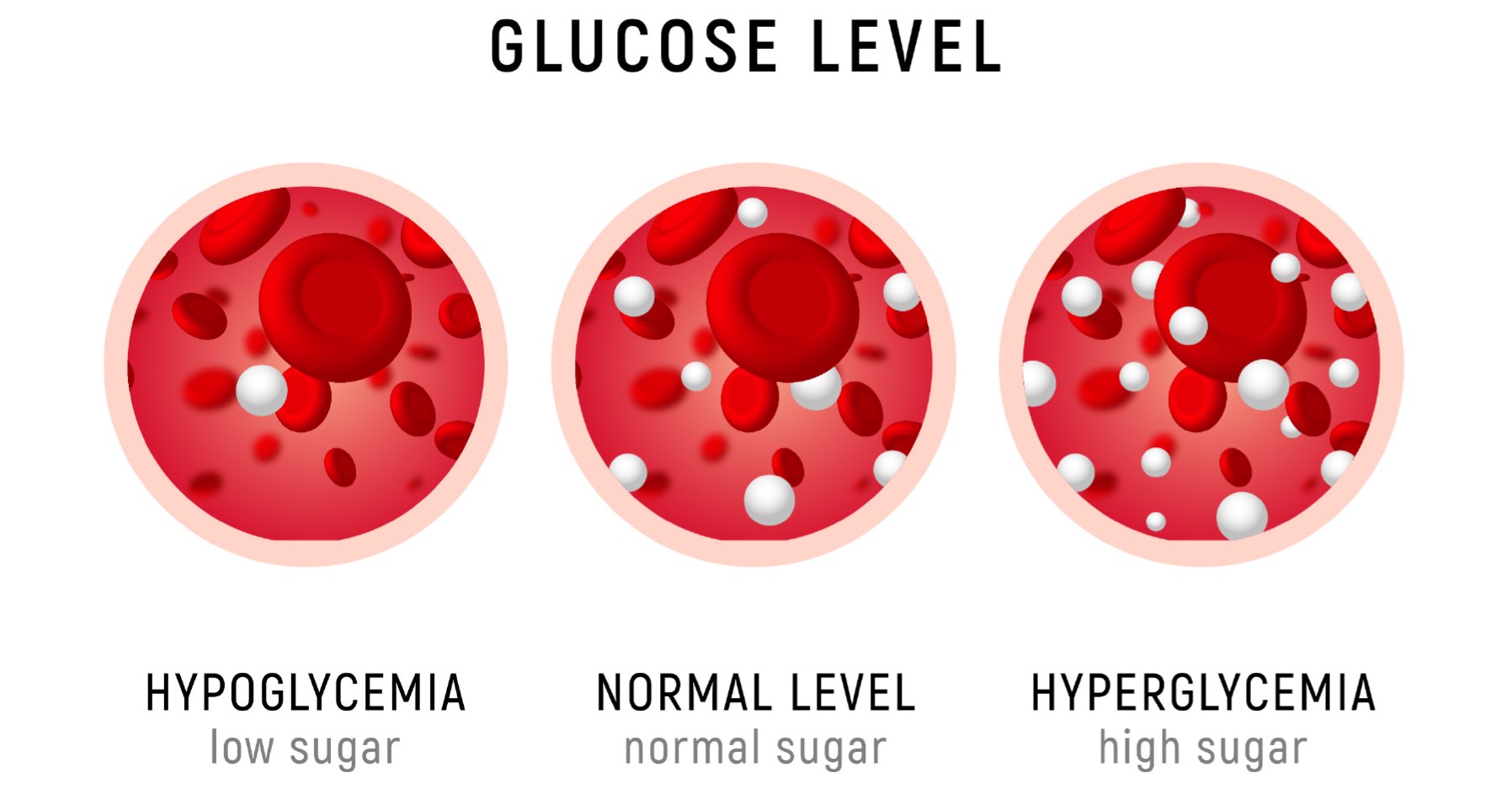 glucose tolerance test hypoglycemia