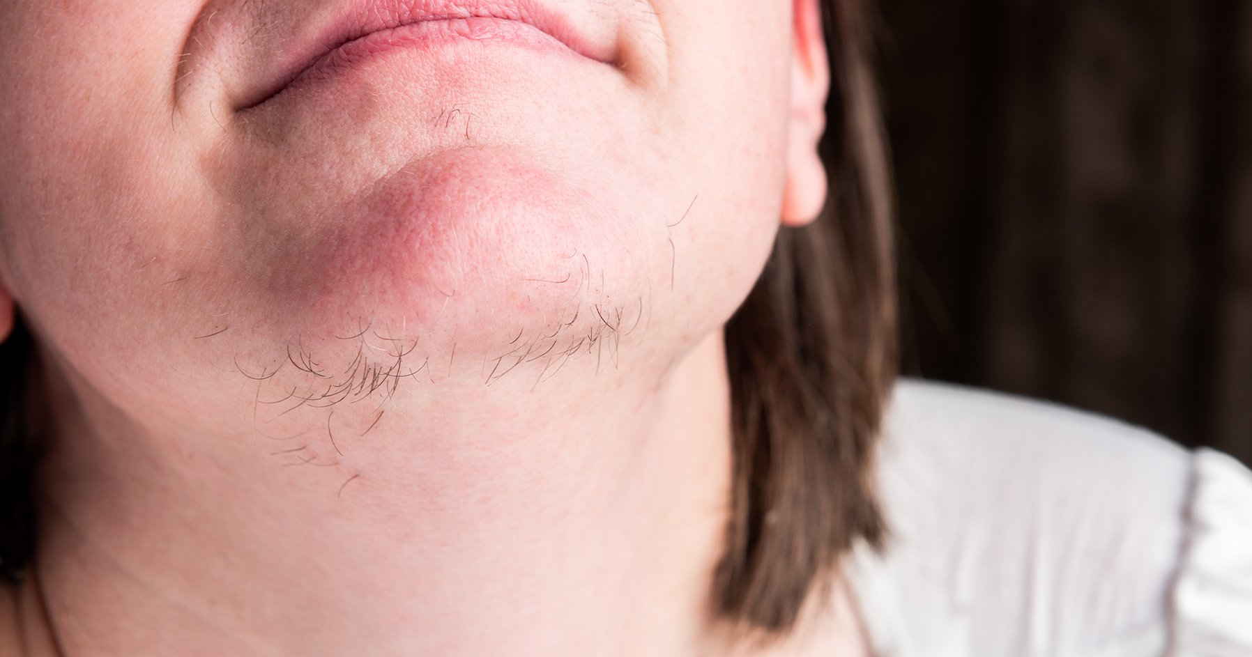 Facial hair in women: Let's bust common myths