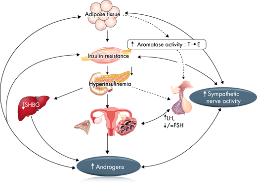 Polycystic Ovary Syndrome Endocrine Society